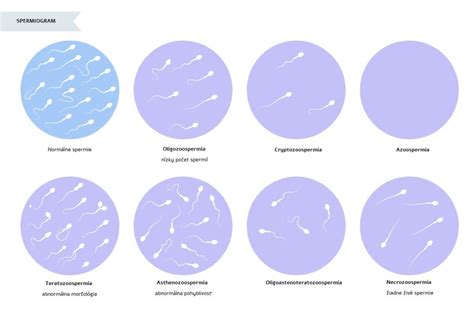infografika zobrazujúca proces tvorby spermií