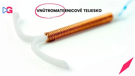 Vnútromaternicové teliesko v tvare T