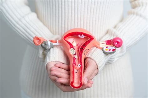 Ilustrácia ženskej maternice s vyznačenými myómami