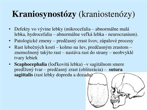 Porovnanie zdravého vývoja lebky a kraniostenózy