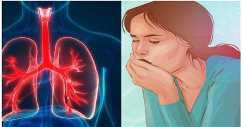 Ilustrácia dieťaťa s nádchou, ktoré má problém s dýchaním