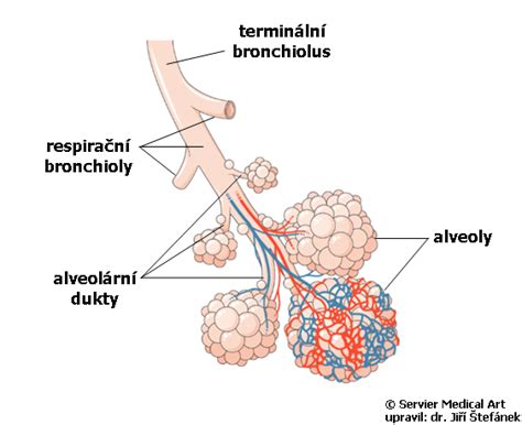 Schematické znázornenie alveol v zdravých pľúcach a pri RDS