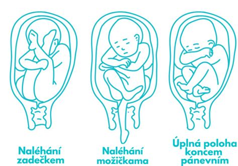 Diagram ukazujúci správnu polohu dieťaťa v nosiči (M-pozícia)
