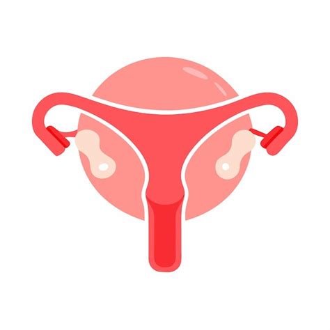 Diagram ženského reprodukčného systému s vyznačenými možnými problémami