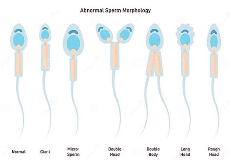 Grafické znázornenie spermií X a Y