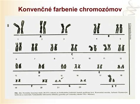 Ilustrácia ľudských chromozómov, vrátane páru pohlavných chromozómov X a Y