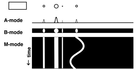 Porovnanie A-mode, B-mode a M-mode zobrazenia