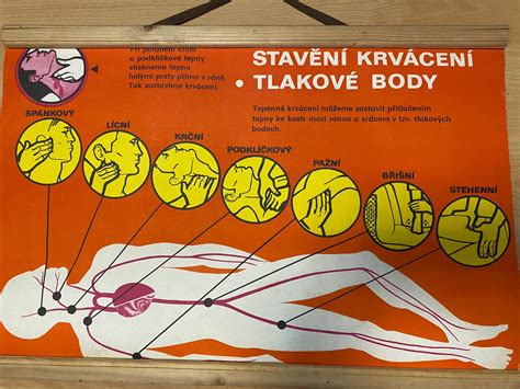 diagram zobrazujúci tlakové body na tele pri ležaní a ako ich polohovací vankúš zmierňuje