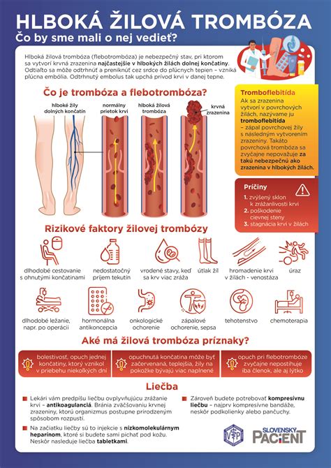 Infografika porovnávajúca prejavy malých a veľkých epileptických záchvatov
