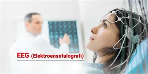 Ilustrácia EEG aparátu