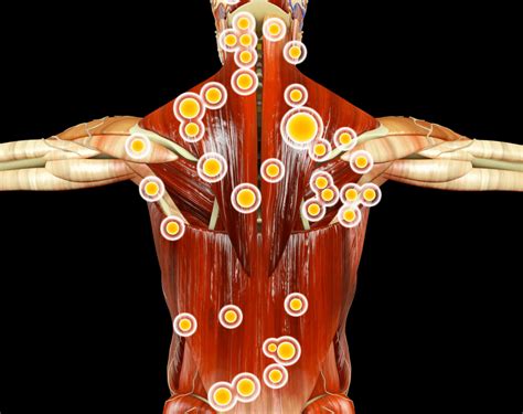 Ilustrácia ženského panvového dna a jeho svalovej štruktúry