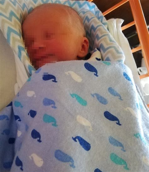 Detailná fotografia žltých šupiniek na hlavičke bábätka