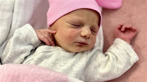 Bábätko pod fotolampou