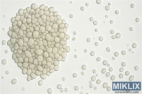 Mikroskopický pohľad na kvasinky Candida