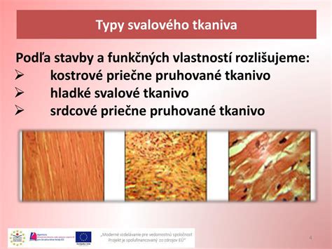 Infografika zobrazujúca aplikáciu ultrazvukovej terapie na svalové tkanivo