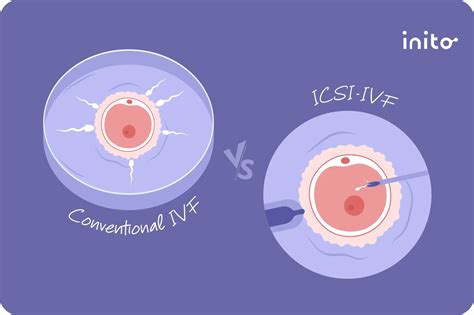 Diagram porovnávajúci metódy IVF, ICSI a inseminácie