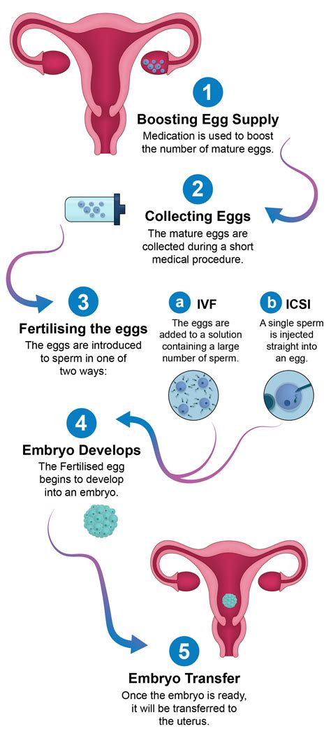 diagram zobrazujúci proces IVF