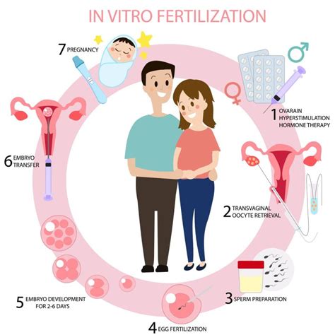 Infografika o procese umelého oplodnenia (IVF)