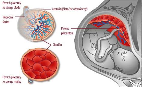 Ilustrácia placenty a jej spojenia s plodom