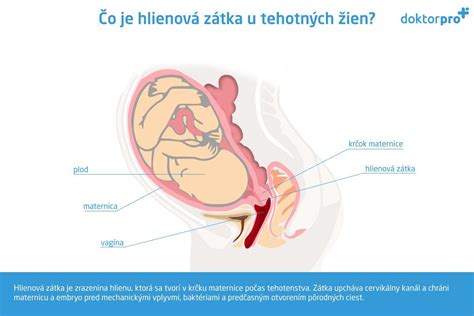 Ilustrácia hlienovej zátky v krčku maternice počas tehotenstva