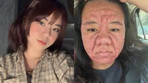 žena s bolesťou v krížoch počas tehotenstva