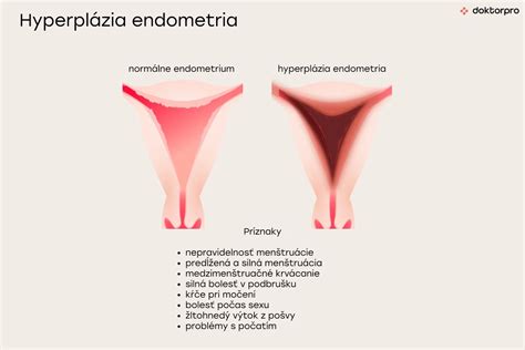 Porovnanie endometriózy a hyperplázie endometria