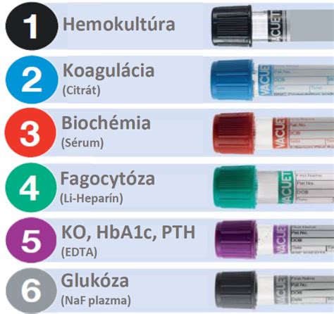 Ilustrácia odberu krvi na diagnostické účely