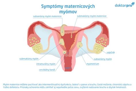 Umiestnenie maternice v panve