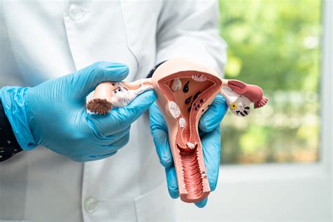 Ilustrácia vaječníkov s folikulmi