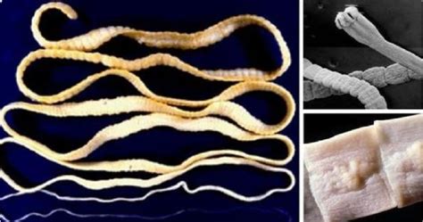 Ilustrácia rôznych druhov črevných parazitov