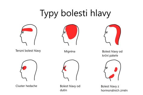 Infografika: Tipy na zmiernenie bolesti hlavy počas dojčenia