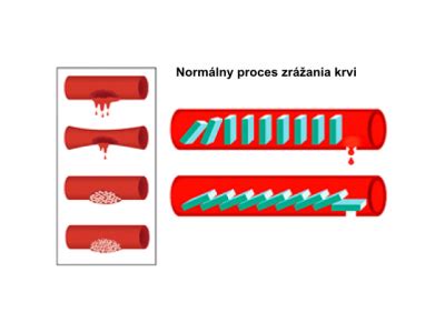 Diagram znázorňujúci proces zrážania krvi