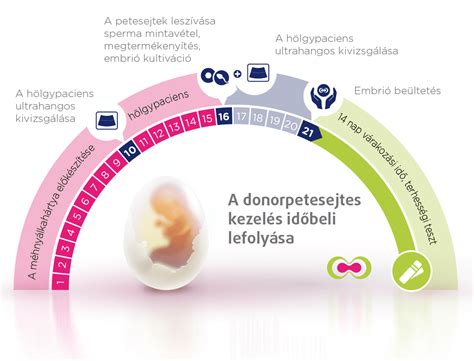 infografika zobrazujúca priebeh IVF