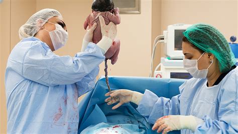 diagram porovnávajúci vaginálny pôrod a cisársky rez