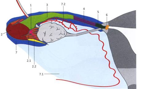 Diagram znázorňujúci vaječník s rôznymi typmi cýst