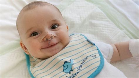 Dieťa s modrinou na tvári