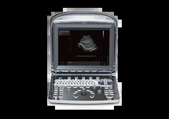 Ultrazvukový prístroj so sondou