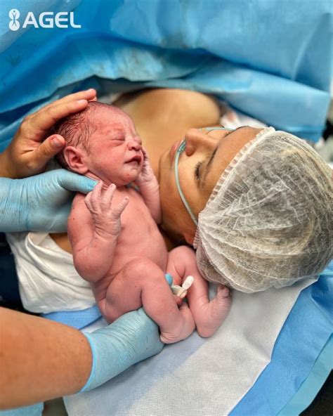 ilustrácia znázorňujúca rôzne typy rezov pri cisárskom reze