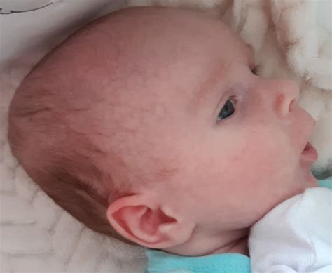 Bábätko v maternici otočené hlavičkou nadol