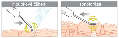 Ilustrácia aplikácie dekoračnej dyhy s použitím špachtle