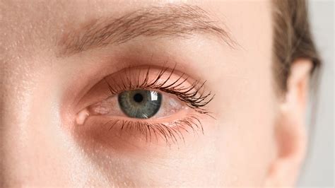 Hnisavý výtok z oka