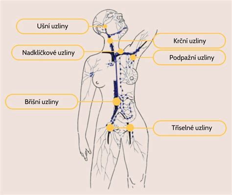 Lymfatické uzliny s pigmentami