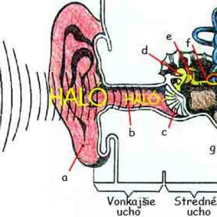 Ilustrácia znázorňujúca rôzne príčiny poruchy sluchu u detí