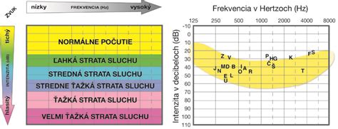 Príklad audiogramu s vyznačenými symbolmi a stupňami straty sluchu