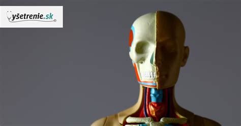 Diagram znázorňujúci rôzne typy cýst v ľudskom tele