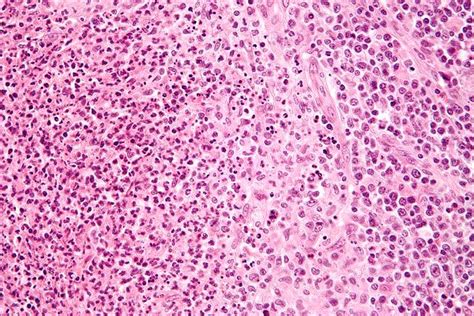 Mikroskopické zobrazenie baktérií