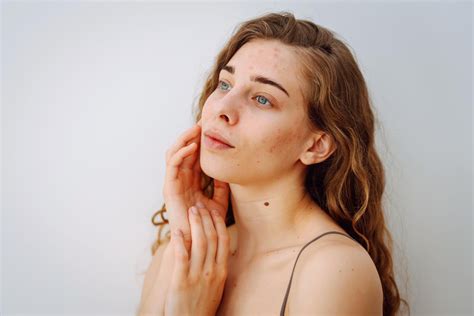 Diagram znázorňujúci rôzne príčiny hrčiek na semenníkoch