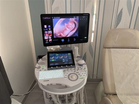 Ultrazvukové sledovanie folikulov