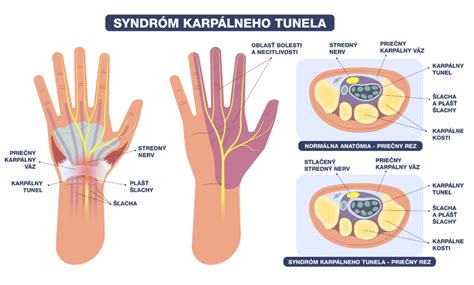 Infografika zobrazujúca správnu techniku aplikácie masti na kožu